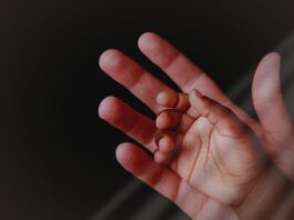 Desejo de adotar falou mais alto e casal recebe bebê com hidrocefalia Imagem notícia Desejo de adotar falou mais alto e casal recebe bebê com hidrocefalia